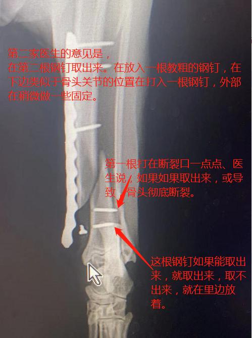 猫咪骨折治疗失败案例_猫咪骨折应急处理：送医前必做事项_宠物医院手术失误索赔