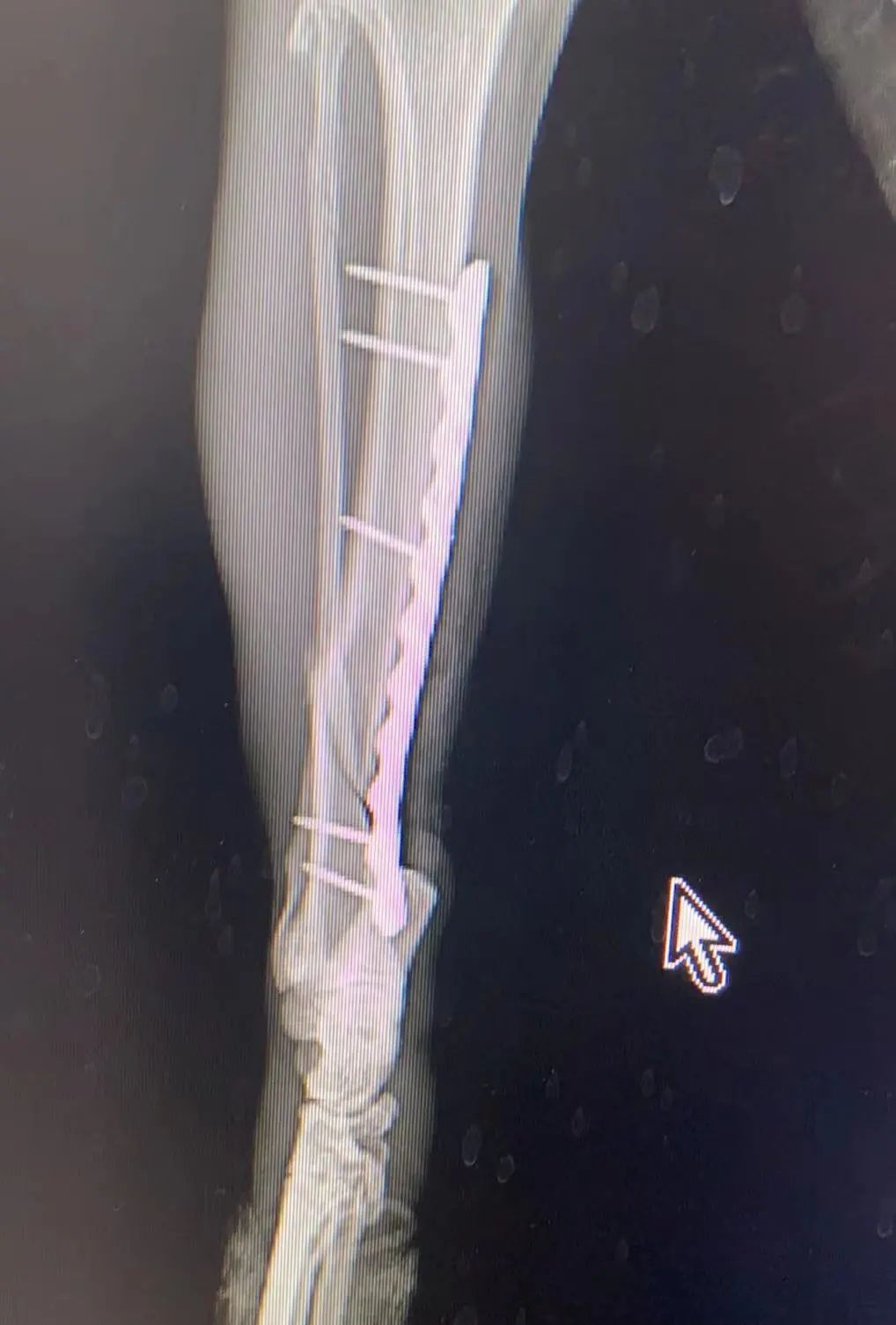 宠物医院手术失误索赔_猫咪骨折治疗失败案例_猫咪骨折应急处理：送医前必做事项
