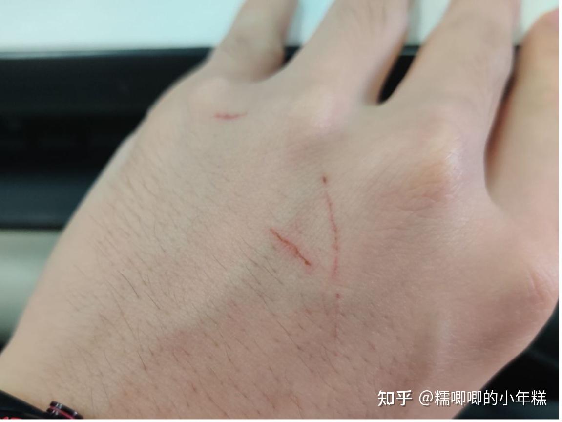 猫咪安全生活环境准备_猫癣的症状表现和家庭处理方法_新手养猫预算建议