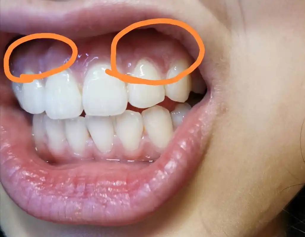 宠物脱水症状识别_宠物脱水原因分析_狗狗皮肤弹力差？脱水和衰老表现
