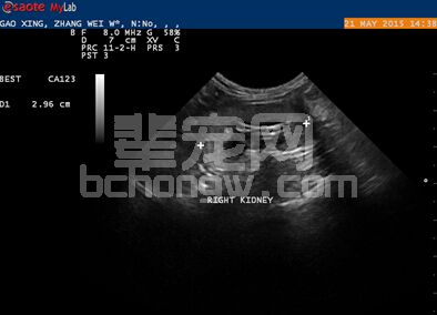 猫咪输尿管结石：比膀胱结石更危险_人工输尿管植入手术_猫输尿管阻塞治疗