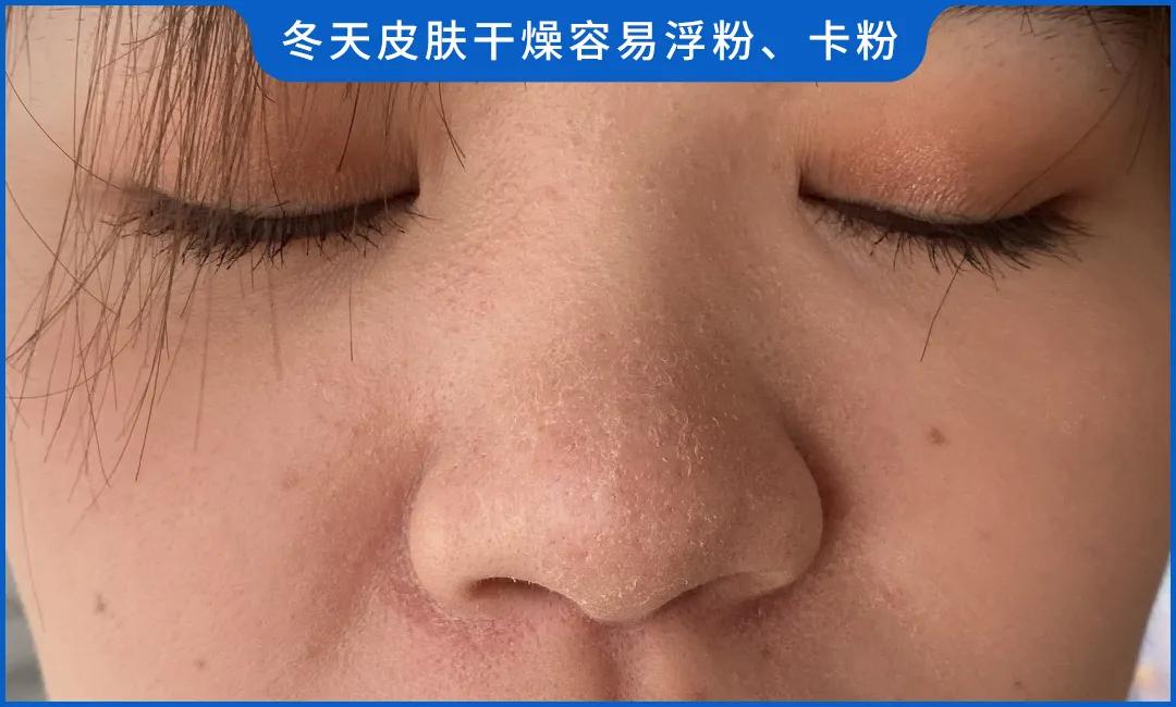 如何选择适合敏感皮肤的洗护品_冬季洗面奶评测_洗面奶成分分析