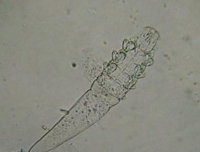 狗狗体外寄生虫防治方法_狗狗体内寄生虫种类_狗狗皮肤铜色？代谢问题和内分泌病