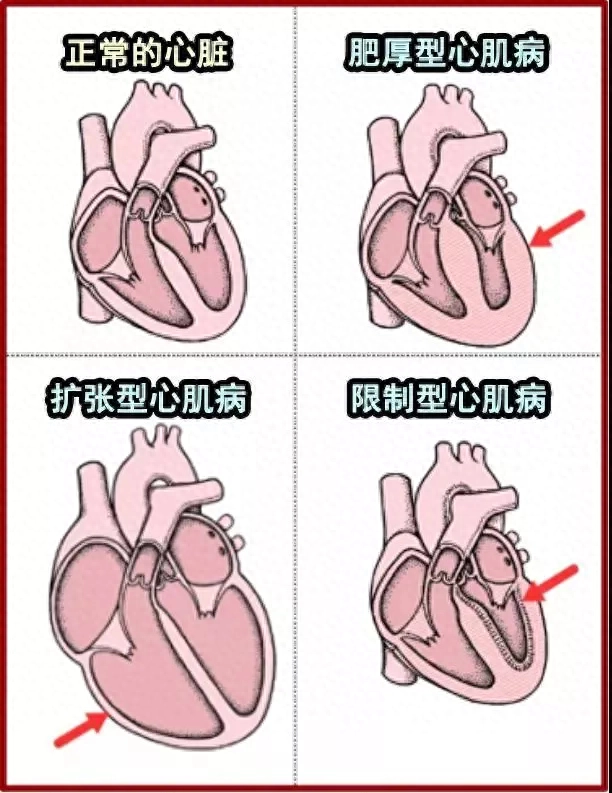 纯种猫近亲繁殖_猫咪丙酮酸激酶缺乏症：贫血基因病_猫咪遗传病