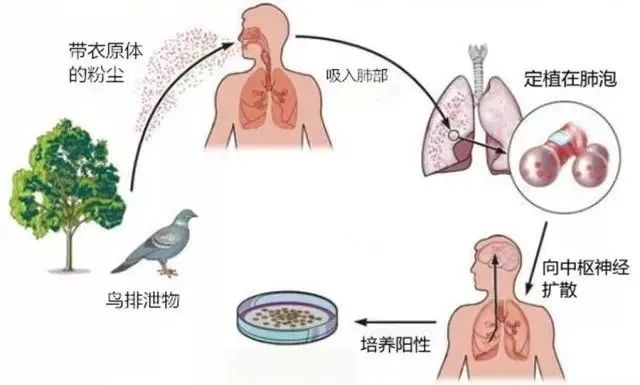 鹦鹉热衣原体感染途径_小太阳鹦鹉容易得什么病_鹦鹉热病例浙江广东