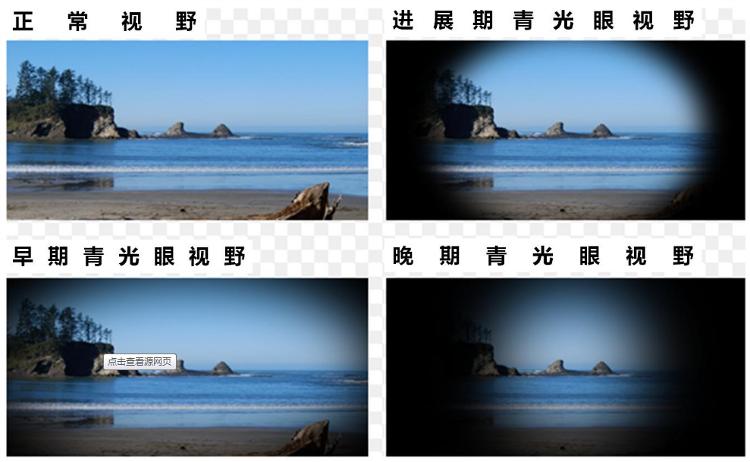 青光眼眼压检查方法_眼压高与青光眼关系_猫咪青光眼：眼压升高的紧急处理