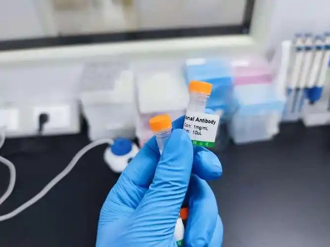 弓形虫检测与预防必备指南-派特超人-宠物