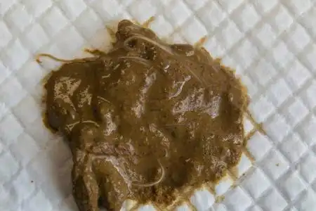 弓形虫检测方法_猫咪弓形虫检测：孕妇养猫必读_猫咪弓形虫预防措施