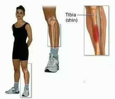 跑步时小腿前侧疼?可能是胫骨筋膜炎在作怪！-派特超人-宠物