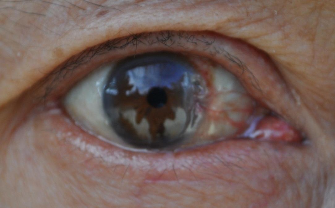 翼状胬肉是什么眼科疾病-派特超人-宠物