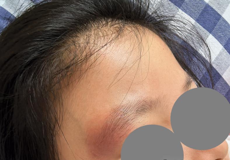 蜱虫叮咬处理方法_蜱虫病预防措施_季节性宠物寄生虫预防方案