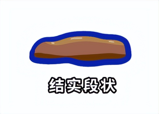猫咪健康便便颜色判断_猫咪粪便检测的意义_猫咪便便形状分析