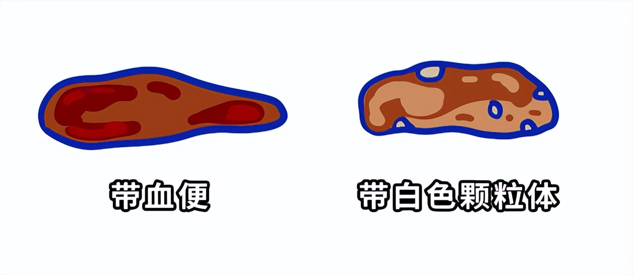 猫咪粪便检测的意义_猫咪便便形状分析_猫咪健康便便颜色判断