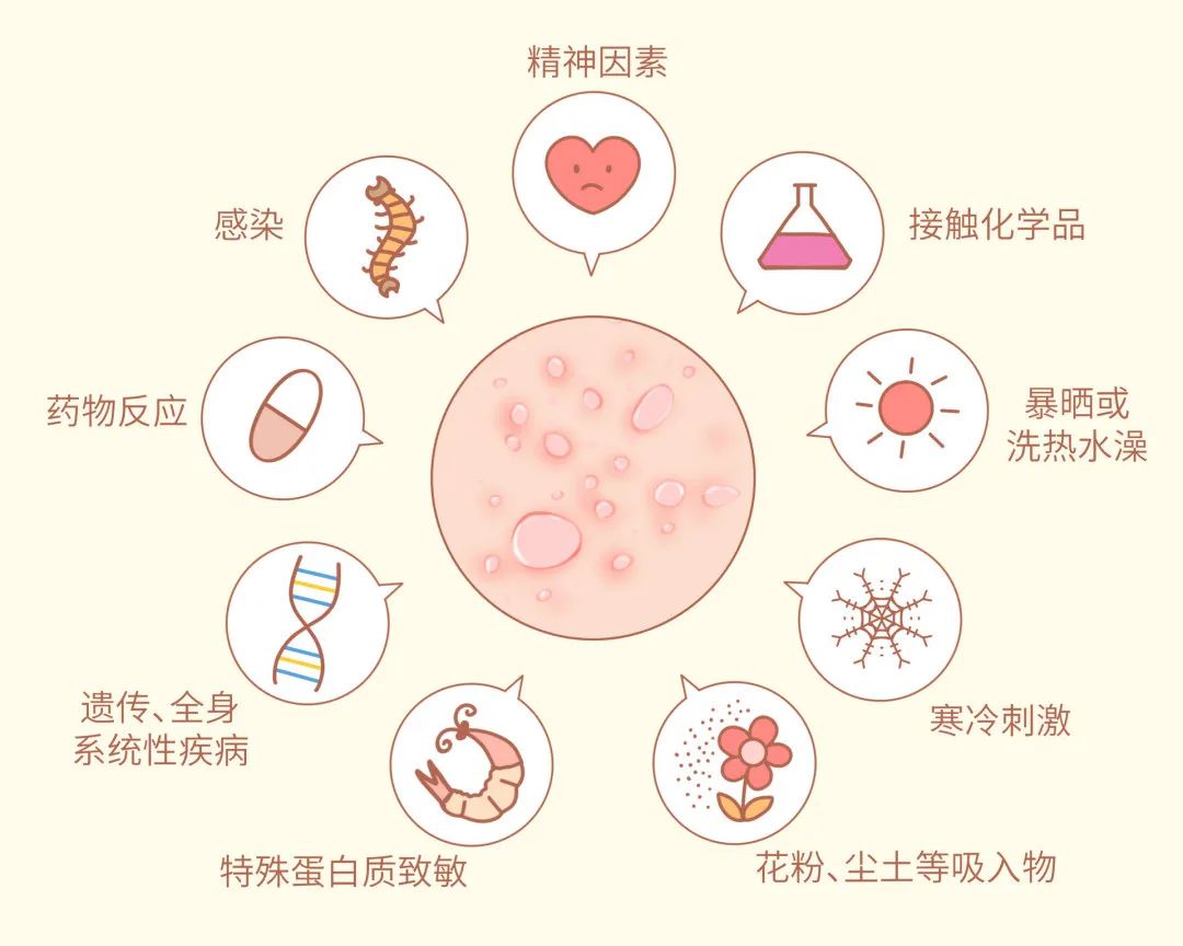 荨麻疹过敏原因_狗狗皮肤起疙瘩？荨麻疹和虫咬反应_荨麻疹中医治疗方法