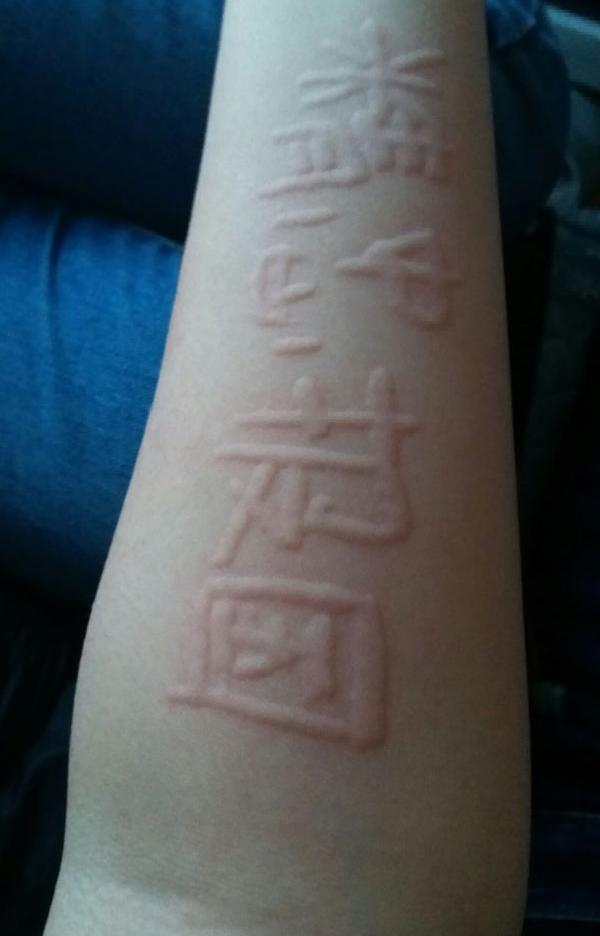 荨麻疹过敏原因_荨麻疹中医治疗方法_狗狗皮肤起疙瘩？荨麻疹和虫咬反应