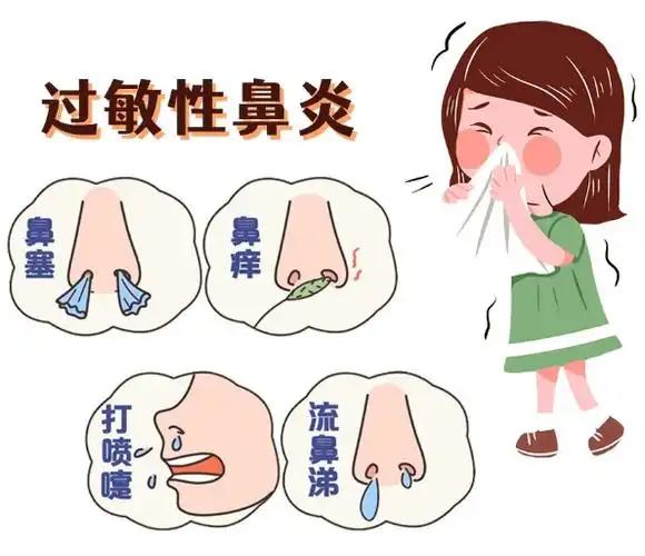 慢性鼻炎发病机制研究_猫咪慢性鼻炎治疗_中西医结合鼻炎治疗策略