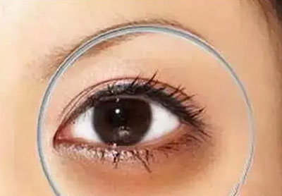 角膜炎为什么迟迟不愈呢？-派特超人-宠物