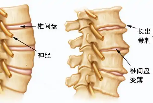 狗狗颈椎病护理方法_狗狗颈椎病症状预防_狗狗颈部僵硬？脑膜炎和颈椎问题