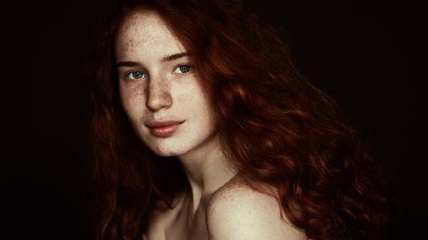 脸上长黄褐斑导致肤色不均匀-派特超人-宠物