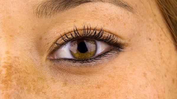 女人脸上的黄褐斑是怎么形成的-派特超人-宠物